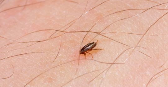A little flea bites on a human